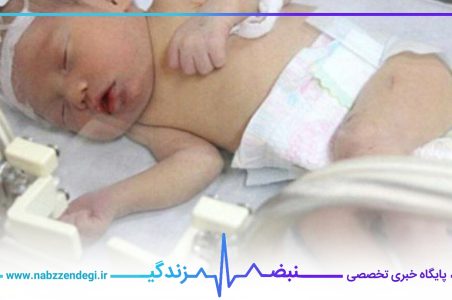 فلج شدن نوزاد بر اثر شکستن قلنج